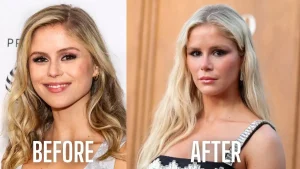 erin moriarty before and after surgeries