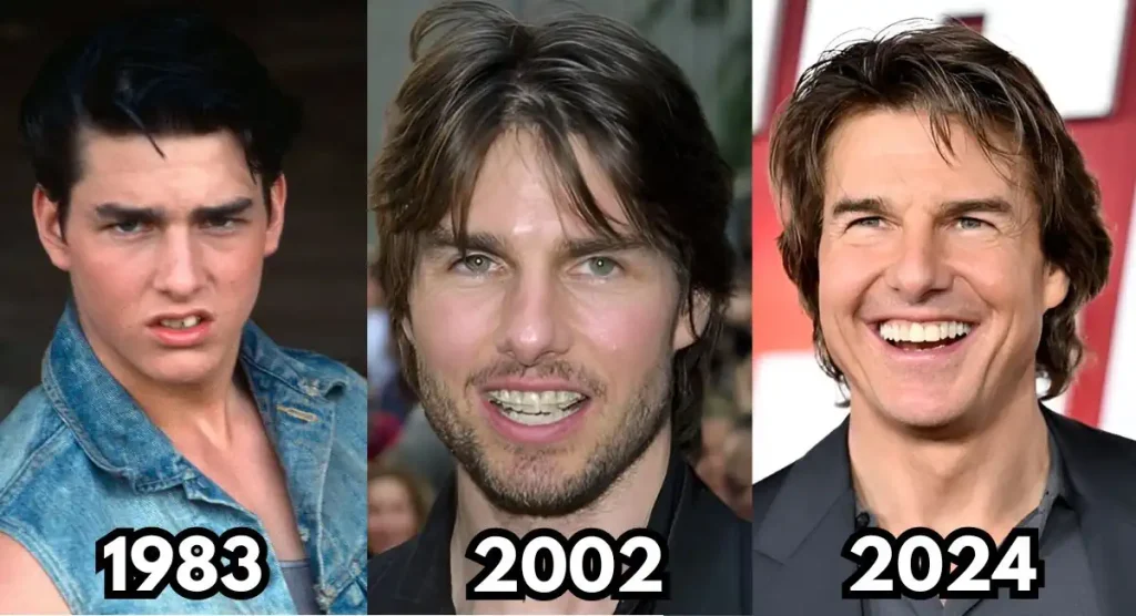 tom cruise teeth